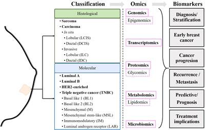 Multiomics insights on the onset, progression, and metastatic evolution of breast cancer